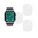 Set 3 folii SILKASE pentru Apple Watch Ultra 2 49mm, silicon, regenerabil, Full-display (SILKASE, Folie Silicon Smartwatch) by www.silkase.ro SILKASE Set 3 Folii Silicon Regenerabil Full-display Apple Watch Ultra 3/2/1 (49mm - 1.92 inch), Lucios (Folie Silicon Smartwatch, W1220) by www.silkase.ro