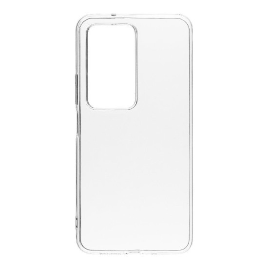 Husa OBAL:ME TPU pentru Xiaomi Redmi 15 4G / 5G, Transparentă (Bakr, 57983128286) by www.silkase.ro