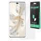 Folie SILKASE pentru Honor 100 Pro, protectie ecran, silicon regenerabil (SILKASE, Folie Silicon Fata Lucioasa) by www.silkase.ro Folie SILKASE pentru Honor 100 Pro, protectie ecran, silicon regenerabil (100 Pro, F7005) by www.silkase.ro