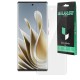 Folie SILKASE pentru ZTE Nubia Z50, protectie ecran, silicon regenerabil (SILKASE, Accesorii ZTE) by www.silkase.ro Folie SILKASE pentru ZTE Nubia Z50, protectie ecran, silicon regenerabil (Nubia Z50, F7162) by www.silkase.ro